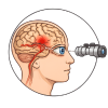 Neuro-Ophthalmology