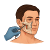 Facial Maxillary Surgery